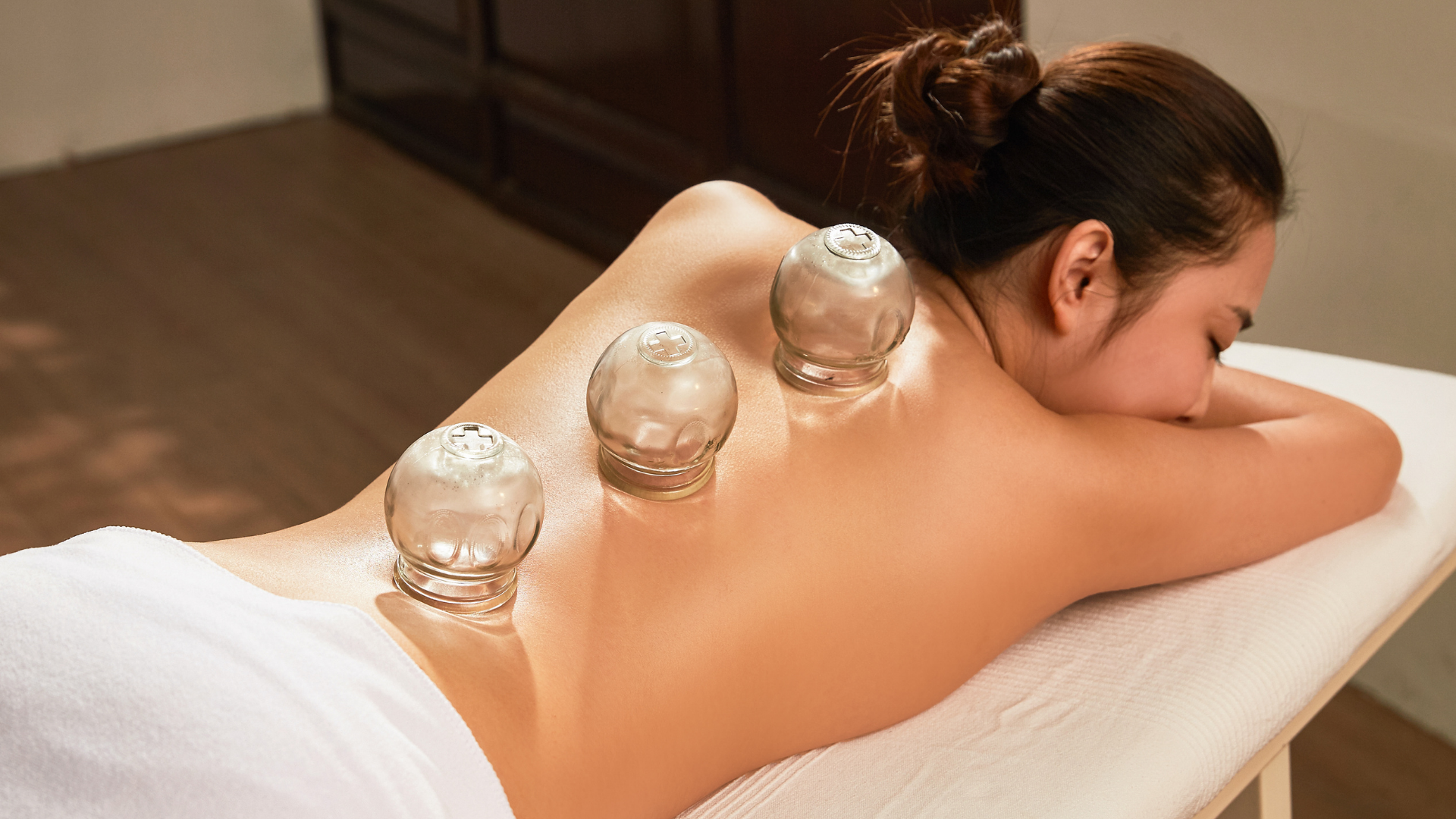cupping 1